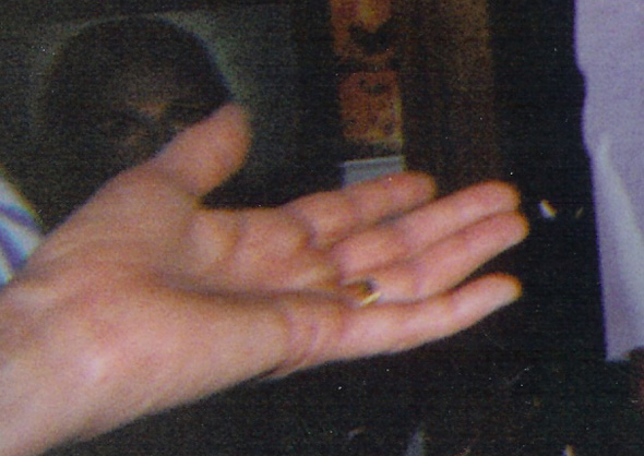 Enlargement of Hand Photo